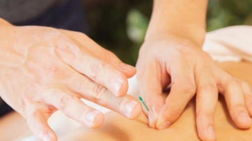 specialisatie dry needling Dry needling Groningen